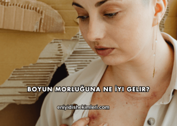 Boyun Morluğuna Ne İyi Gelir?