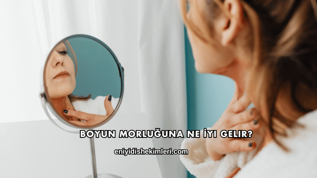 Boyun Morluğuna Ne İyi Gelir?