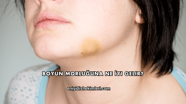 Boyun Morluğuna Ne İyi Gelir?