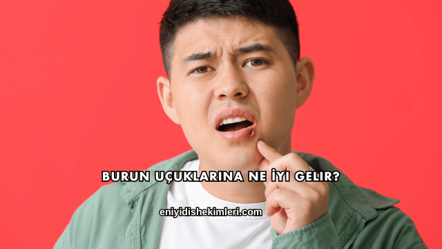 Burun Uçuklarına Ne İyi Gelir?