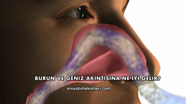 Burun ve Geniz Akıntısına Ne İyi Gelir?
