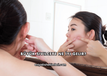 Büyük Sivilceye Ne İyi Gelir?