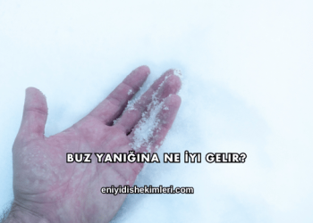 Buz Yanığına Ne İyi Gelir?