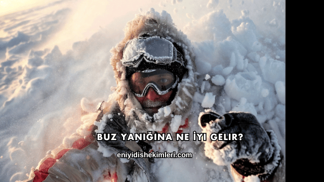 Buz Yanığına Ne İyi Gelir?