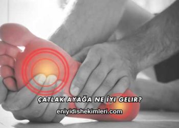 Çatlak Ayağa Ne İyi Gelir?