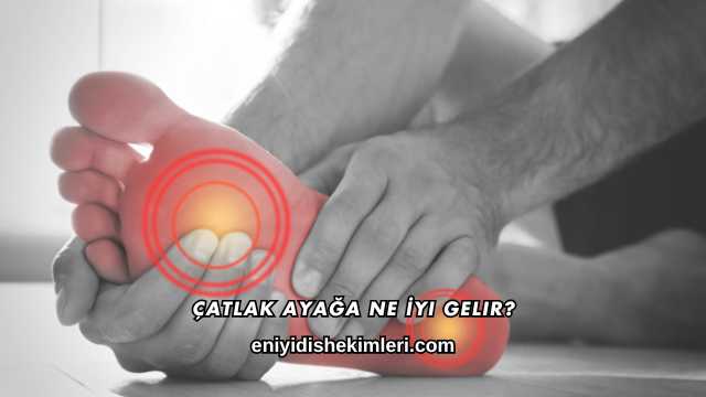 Çatlak Ayağa Ne İyi Gelir?