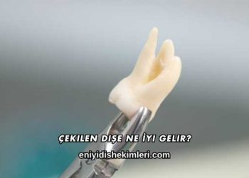 Çekilen Dişe Ne İyi Gelir?
