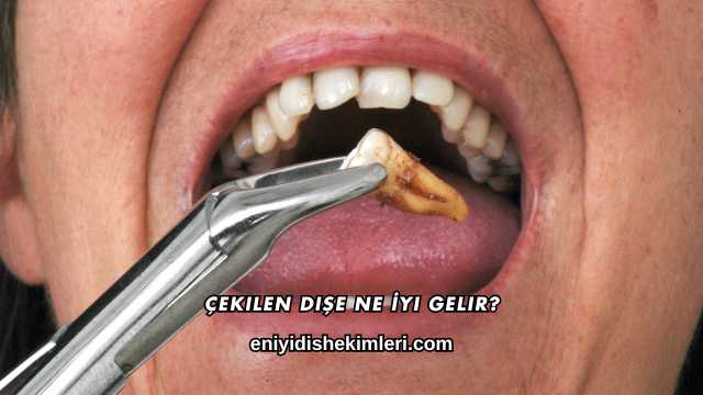 Çekilen Dişe Ne İyi Gelir?