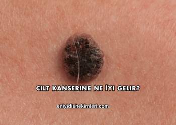 Cilt Kanserine Ne İyi Gelir?