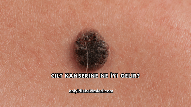 Cilt Kanserine Ne İyi Gelir?