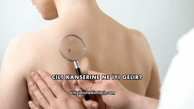 Cilt Kanserine Ne İyi Gelir?
