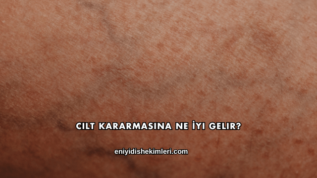 Cilt Kararmasına Ne İyi Gelir?