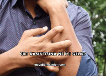 Cilt Kaşıntısına Ne İyi Gelir?