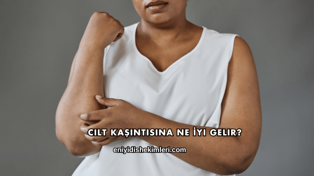 Cilt Kaşıntısına Ne İyi Gelir?