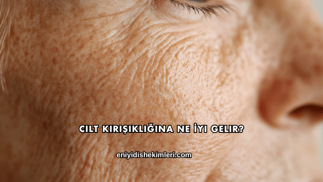 Cilt Kırışıklığına Ne İyi Gelir?