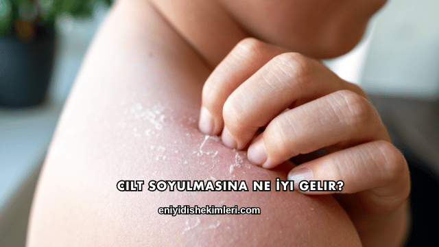 Cilt Soyulmasına Ne İyi Gelir?