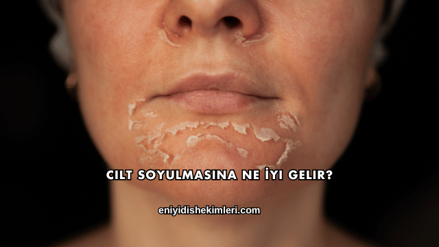 Cilt Soyulmasına Ne İyi Gelir?