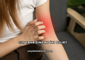 Cilt Tahrişine Ne İyi Gelir?