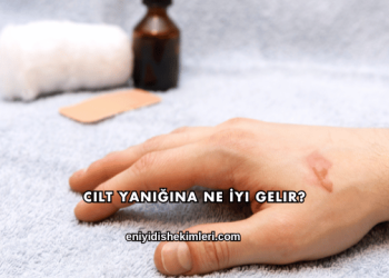 Cilt Yanığına Ne İyi Gelir?