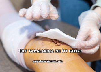 Cilt Yaralarına Ne İyi Gelir?