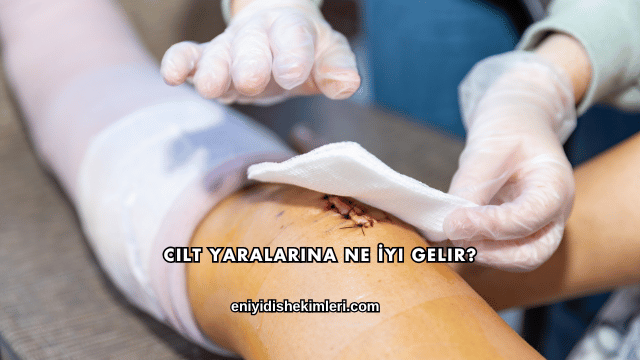 Cilt Yaralarına Ne İyi Gelir?