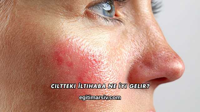Ciltteki İltihaba Ne İyi Gelir?