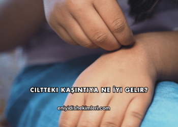 Ciltteki Kaşıntıya Ne İyi Gelir?