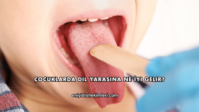 Çocuklarda Dil Yarasına Ne İyi Gelir?