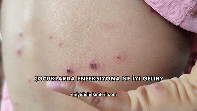 Çocuklarda Enfeksiyona Ne İyi Gelir?