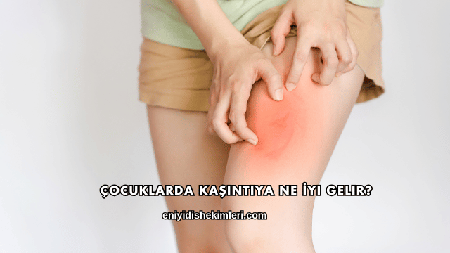 Çocuklarda Kaşıntıya Ne İyi Gelir?