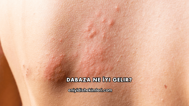Dabaza Ne İyi Gelir?