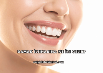 Damak İltihabına Ne İyi Gelir?