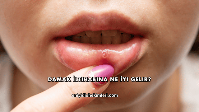 Damak İltihabına Ne İyi Gelir?