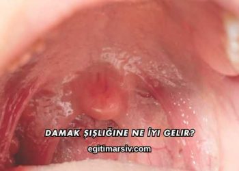 Damak Şişliğine Ne İyi Gelir?