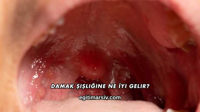 Damak Şişliğine Ne İyi Gelir?