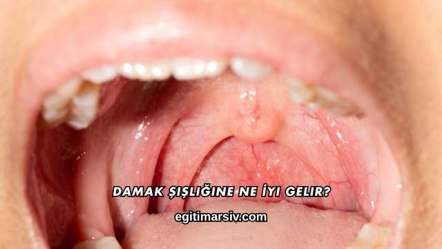 Damak Şişliğine Ne İyi Gelir?
