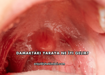Damaktaki Yaraya Ne İyi Gelir?
