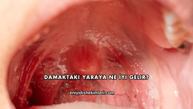 Damaktaki Yaraya Ne İyi Gelir?