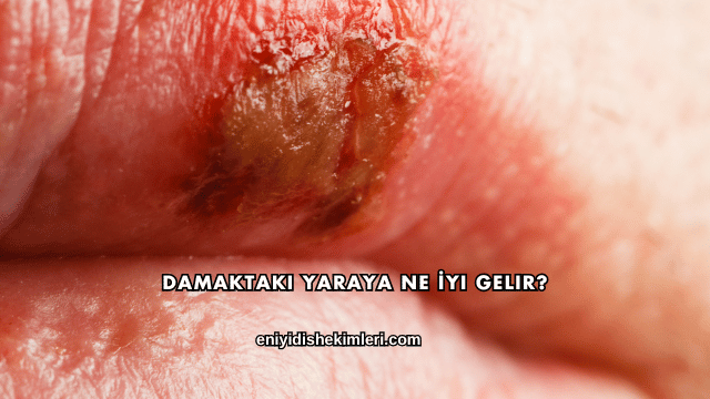 Damaktaki Yaraya Ne İyi Gelir?
