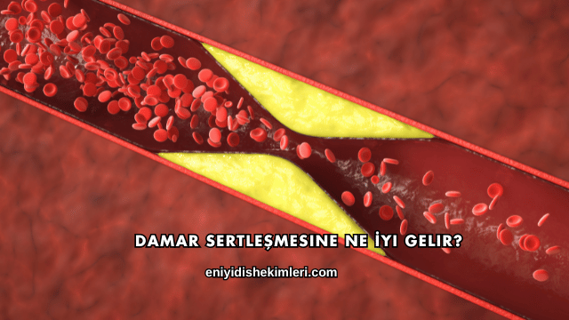 Damar Sertleşmesine Ne İyi Gelir?