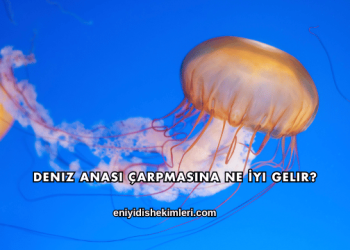 Deniz Anası Çarpmasına Ne İyi Gelir?