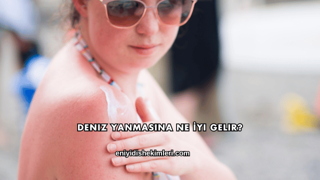 Deniz Yanmasına Ne İyi Gelir?