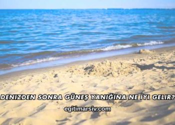 Denizden Sonra Güneş Yanığına Ne İyi Gelir?