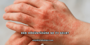 Deri Döküntüsüne Ne İyi Gelir?