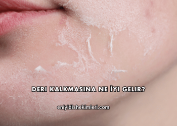 Deri Kalkmasına Ne İyi Gelir?