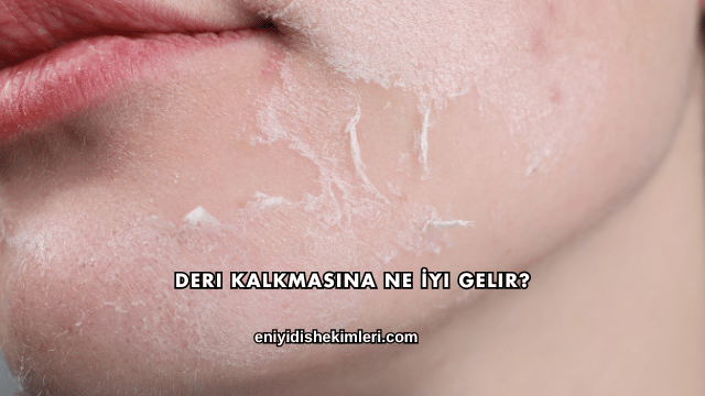 Deri Kalkmasına Ne İyi Gelir?