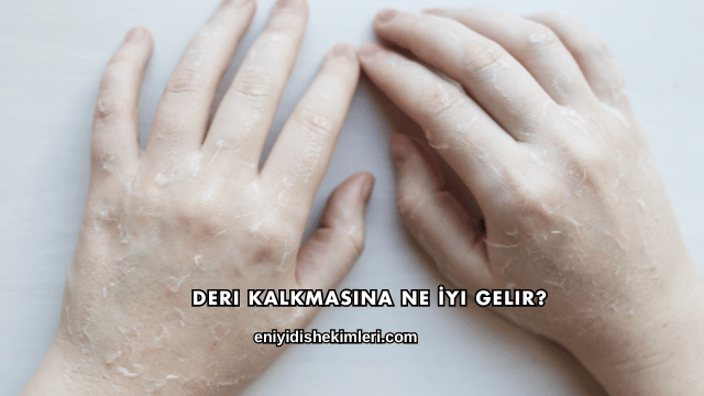 Deri Kalkmasına Ne İyi Gelir?