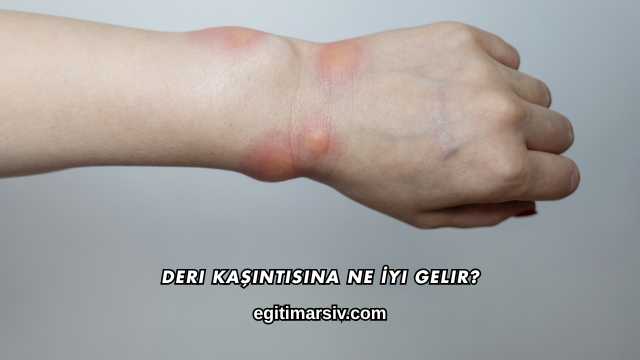 Deri Kaşıntısına Ne İyi Gelir?