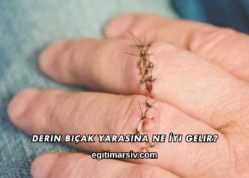 Derin Bıçak Yarasına Ne İyi Gelir?