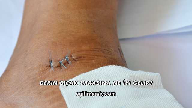 Derin Bıçak Yarasına Ne İyi Gelir?